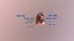 3D model of Lungs