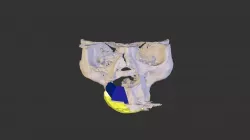 A-1