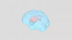 Brain & Brain tumor 3D model