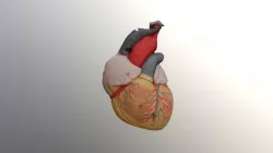 Broken Heart