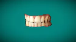 Bruno teeth