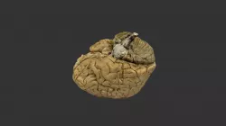 CEREBRO