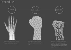 3D Printed Exoskeleton (Theoretical)