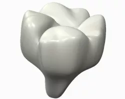 wisdom tooth