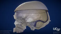 CPs - Model 9: Venous Structures