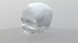 CT Scan Skull