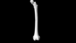 CT_test