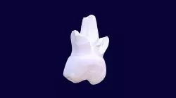 deciduos tooth
