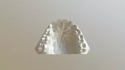 denticion mixta modelo superior