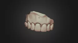 G13#8wax2scan2 Upper Jaw