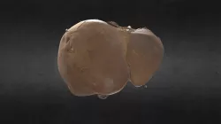 Hígado/Liver