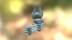 Knee - Proximal Tibia Fracture sku 057