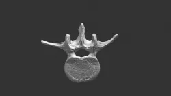 Lumbar Vertebra