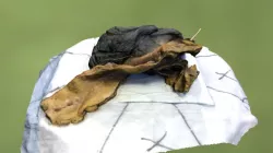 Lung