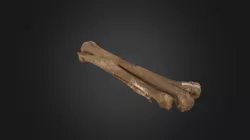 Metacarpo con polidactilia