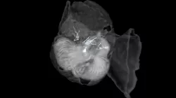 Model 68A - Bathochordaeus stygius larvacean