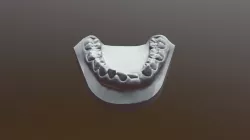 modelo inferior denticion mixta
