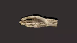 Palmar Hand tendons, nerves, arteries