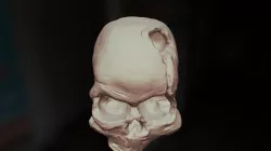 Paracas skull