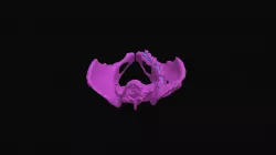 Pelvis Segment