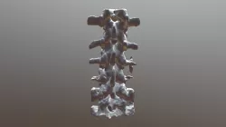 spine
