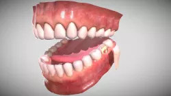 Teeth Denture gums and tongue cutted tooth