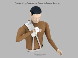 Dynamic Hand Support for ET Reducing
