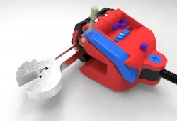 MS prosthetic hand