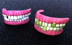 TEETH %%