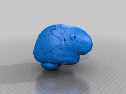 The Puzzling Human Brain