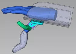 Thumb Device for Partial Hand Amputation 