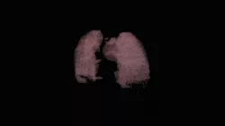 Tissue 2