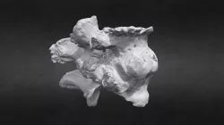 Vertebra 1 L4-L5