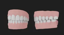 Teeth 3D model