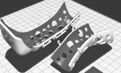 splints 3D Models | Page 1 | STLFinder