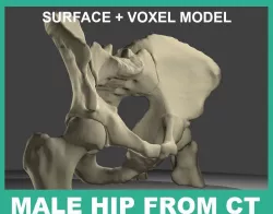HUMAN HIP BONES FROM CT-SCAN 3D model