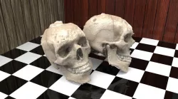 3D scan of a Skull 