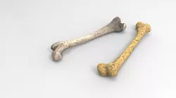 Bone