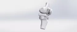 knee