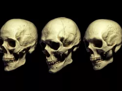 3D SKULL MODELS - HUMAN PACK 3D model