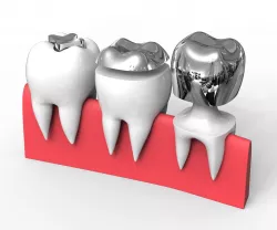 Teeth Cap 3D model