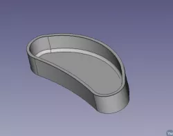 Kindey Tray