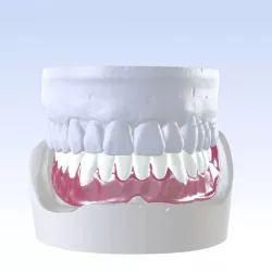 Digital Single Jaw Full Denture