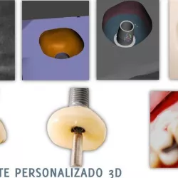SCAR PLUG, BASE FOR GENERATING EMERGENCY PROFILE