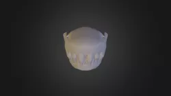 Dentes