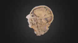 Midsagittal Cross-section of Human Head