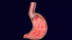 Stomach Gastric Seperable Parts
