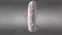 Finger Cast