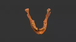 Homo sapiens (Predmost 3) (1979rp47-1)- mandible
