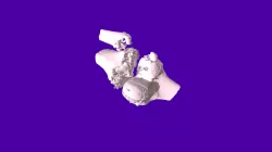 Knee Scan Model